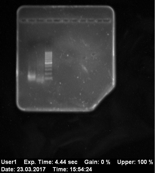 Ergebnis einer Gelelektrophorese (Haplo-Gruppe N)